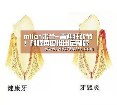 milan米兰-喜迎狂欢节!科隆再度推出定制版特别球衣(图3) 米兰·(milan)中国官网